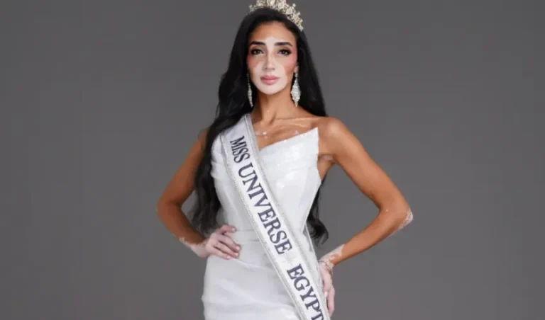 Miss Universo 73 | Logina Salah, la primera concursante con vitiligo, hace historia en México