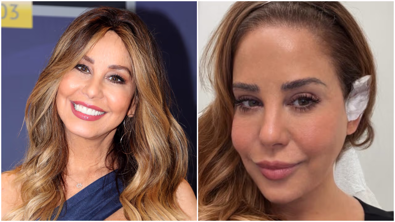 Myrka Dellanos revela que fue diagnosticada con cáncer de piel y ya fue operada