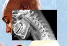 ¿El celular está cambiando tu cuerpo? Expertos alertan sobre el «cuerpo de teléfono»